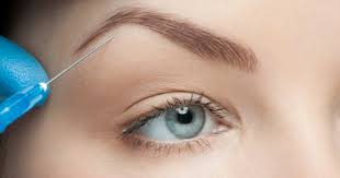 Ultimate Botox Brow Lift Guide